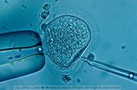 In vitro ferilization technique showing single sperm being injected into the cytoplasm of an egg cell